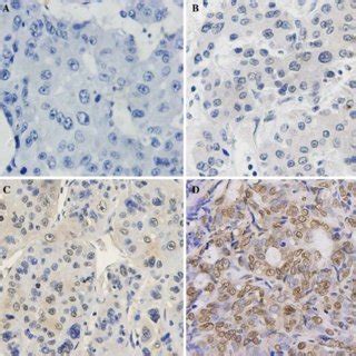 Representative Pictures Of Immunohistochemical Staining Of Hif A In