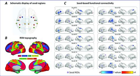 Seed Based Functional Connectivity A Schematic Display Of The Download Scientific Diagram