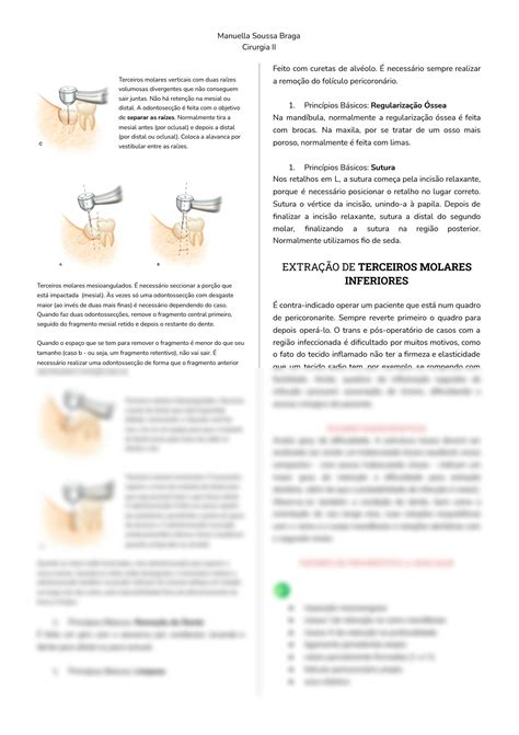 Solution Protocolo Cir Rgico Para Terceiros Molares Inferiores