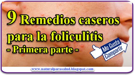 9 Remedios Caseros Para La Foliculitis