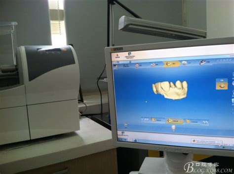 瓷睿刻 CEREC 个性化铸瓷无备牙贴面 种植牙医 李喆的博客 KQ88口腔博客