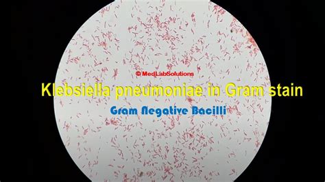 Klebsiella Pneumoniae Gram Stain Slide Share | Hot Sex Picture