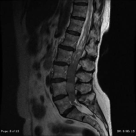 Sagittal T2 Weighted Image Download Scientific Diagram