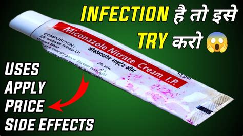 Fungal Infection क रमबण इलज miconazole nitrate cream ip