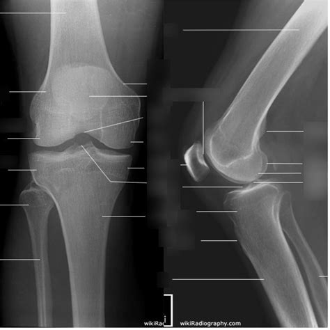 Knee Label Diagram Quizlet