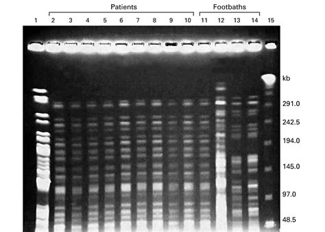 Pulsed Field Gel Electrophoresis Of Representative Isolates From