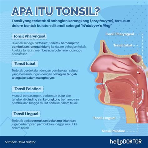 Tonsil Bengkak Apa Punca Gejala Kesan Kondisi Pada Tekak Ini