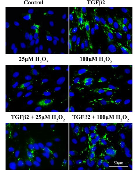 Effects of H 2 O 2 and TGFβ2 on fibronectin of the ARPE 19 cells