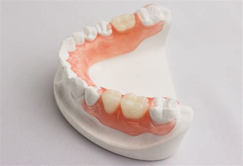 flexible partials cosmetic dental services