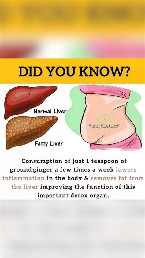 Fatty Liver Diet Plan And Foods To Eat And Avoid Artofit