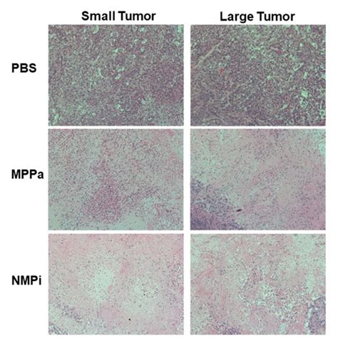 H E Staining Of Tumor Tissues In A549 Tumor Bearing Mice Small Tumor