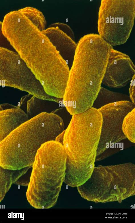 E Coli Bacteria Coloured Scanning Electron Micrograph Sem Of Escherichia Coli O157h7