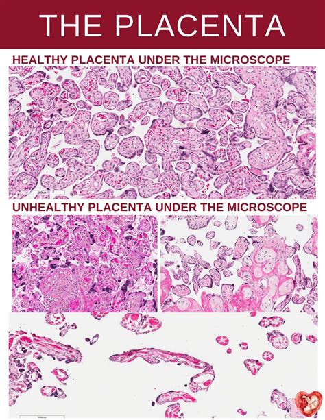 Histology By The Placenta Lab Issuu