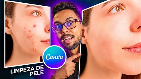 Tratamento E Limpeza De Pele No Canva A Pele Perfeita Nas Suas Fotos