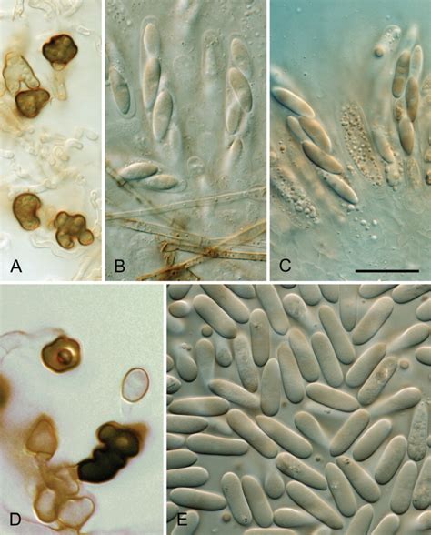 Colletotrichum Clidemiae A B E ICMP 18658 Ex Holotype Culture C