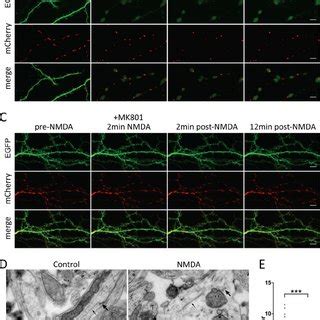 Rapid structural changes in hippocampal neurons in response to an ... 