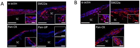 A B Photomicrographs of SMC contractile protein expression α actin