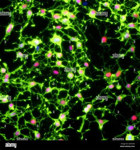 Glial stem cell culture. Fluorescent light micrograph of glial stem ... 