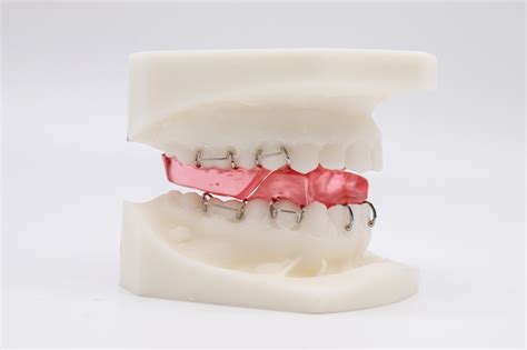 Functional Appliances British Orthodontic Society Bos