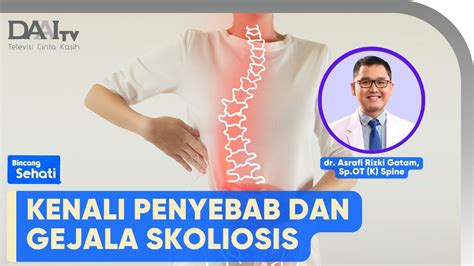 Deteksi Dini Skoliosis Bincang Sehati YouTube