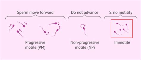 What Happens If Progressive Sperm Motility Is Above 32 But Total