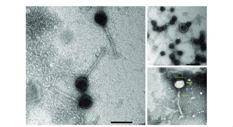 Transmission Electron Micrograph Of Phage Vb Kpn Zckp P Phage