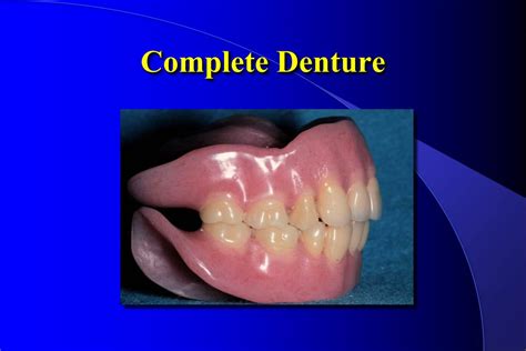 Ppt Complete Denture Powerpoint Presentation Free Download Id6081253