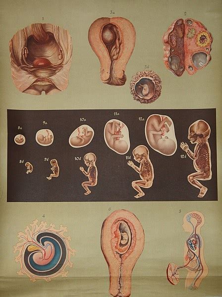Lehrtafel Keimesentwicklung Ii Krankenhausmuseum Bielefeld E V