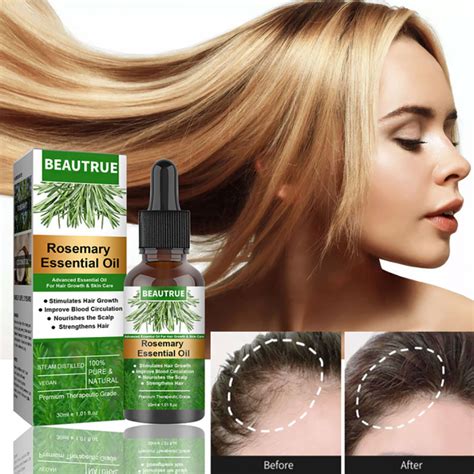 Eelhoe Rosemary Essential Oil Hair Growth Anti Hair Loss Lazada Ph