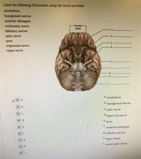 Solved Label The Following Illustration Using The Terms