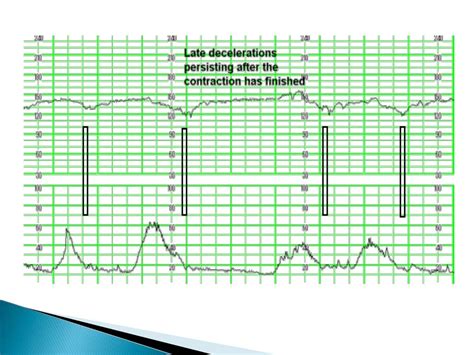 Cardiotocograph