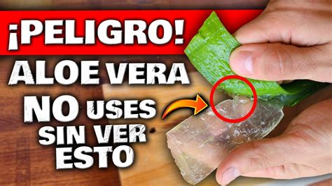 Cuidado Esto Pasa Si Usas Aloe Vera O S Bila Debes Ver Esto