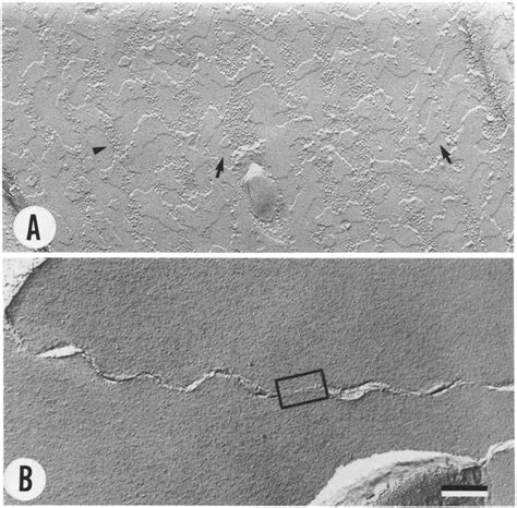 Freeze Fracture Electron Micrographs Of Membrane Contacts Made By