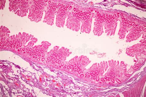 Tissue Of Small Intestine Duodenum Large Intestine Human And Stomach