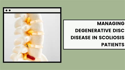 Managing Degenerative Disc Disease In Scoliosis Patients Exercises For