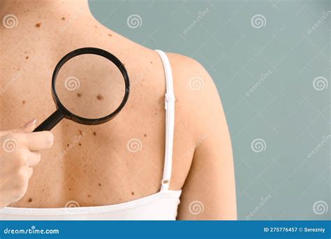 Dermatologist Examining Moles Of Patient On Grey Background Stock Image