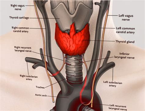 Figure Recurrent Laryngeal Nerves Image Courtesy S Bhimji Md