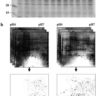 Comparative Proteome Profile Proteomics Analysis Was Performed In