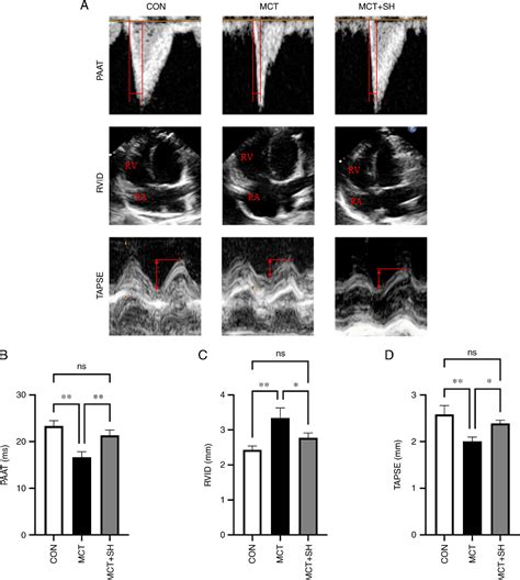 Figure From Shikonin Improves Pulmonary Vascular Remodeling In