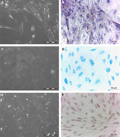 Following Induction Of Adipogenic Chondrogenic And Osteogenic Download Scientific Diagram