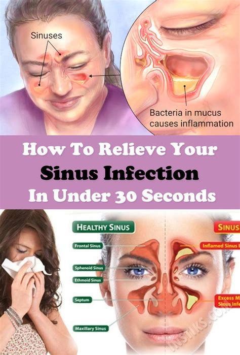 How To Relieve Sinus Pressure In Nose