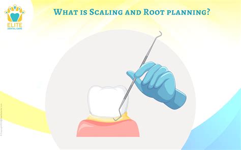 What Is Scaling And Root Planing Elite Dental Care