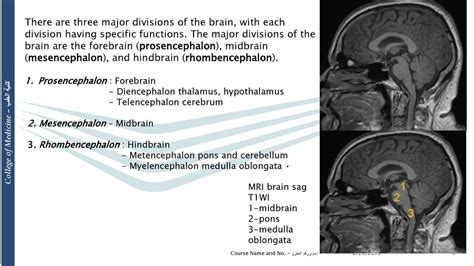 Brain Stem And Cerebellar Imaging Ppt Download