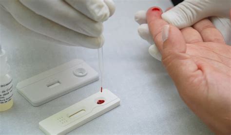 Testes rápidos de HIV estão disponíveis nas unidades de saúde de Natal