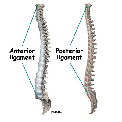 Diffuse Idiopathic Skeletal Hyperostosis - eOrthopod.com