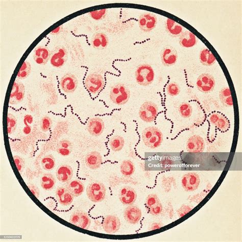 Streptococcus Pyogenes Bacteria