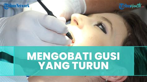 Cara Mengobati Dan Mencegah Gusi Yang Turun Youtube