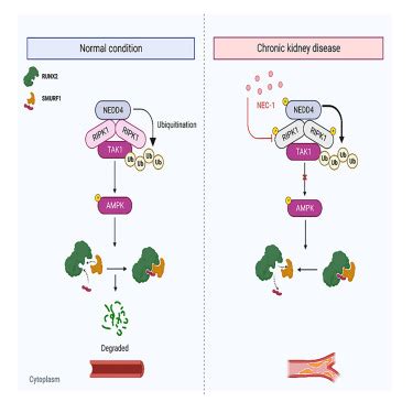 Inhibition Of Ripk Alleviating Vascular Smooth Muscle Cells Osteogenic