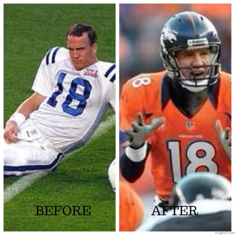 Peyton Manning Plastic Surgery Photos [Before & After] - Surgery4