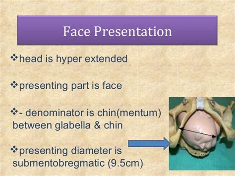 Shoulder presentation